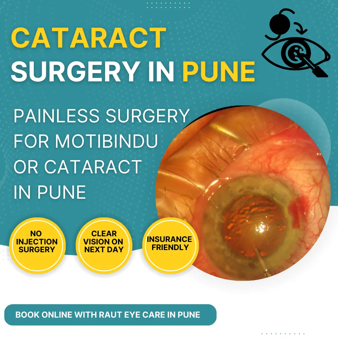 Cataract surgery pune