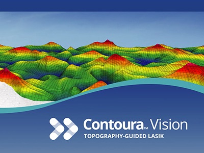 What is Contoura lasik vision in pune?