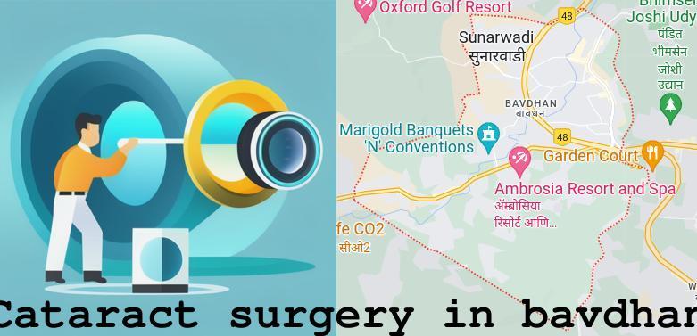 Cataract surgery in Bavdhan