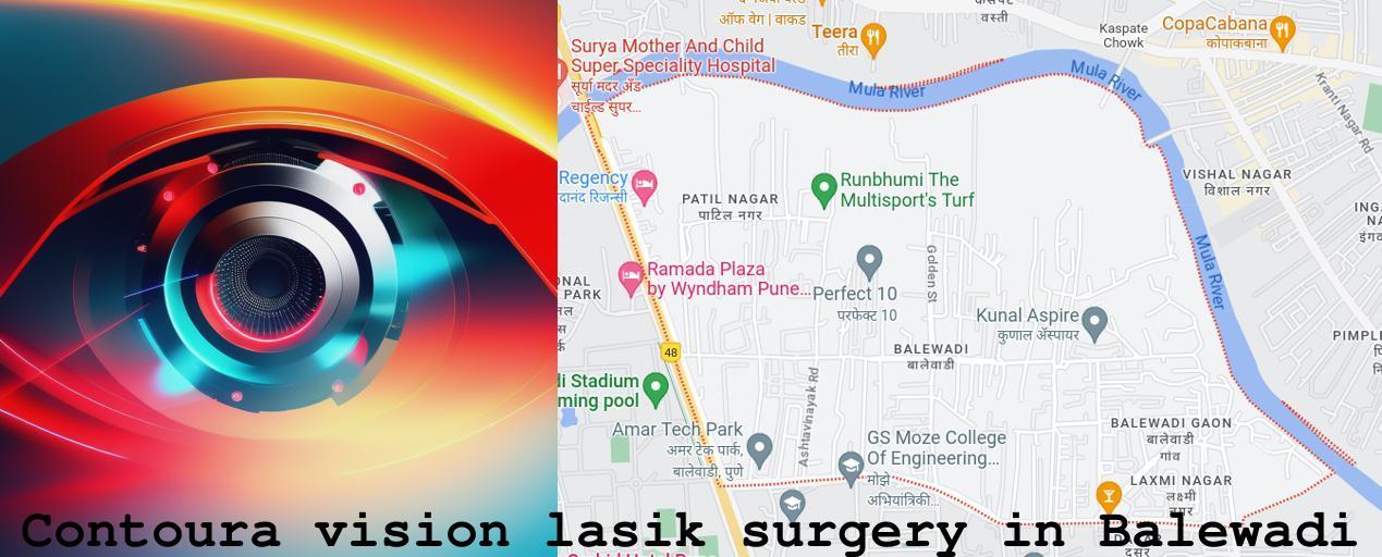 Contoura Vision LASIK Surgery in Balewadi