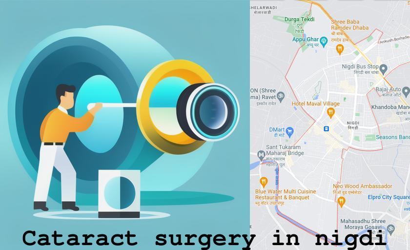 Cataract surgery in Nigdi