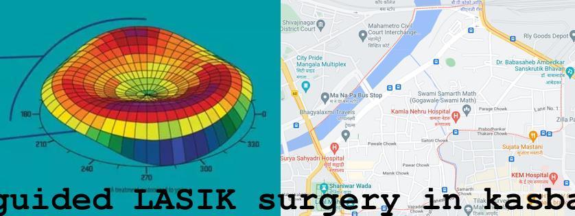 Topo-guided LASIK surgery in Kasba Peth