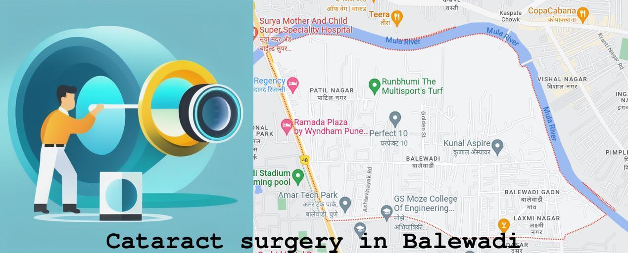 Cataract surgery in Balewadi