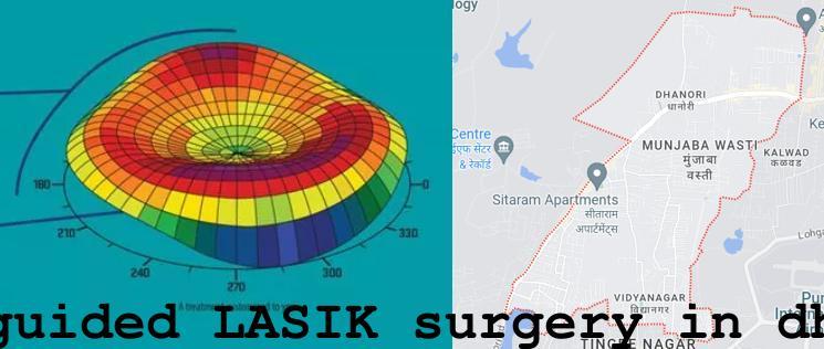 Topo-guided LASIK surgery in Dhanori