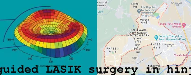 Topo-guided LASIK surgery in Hinjawadi