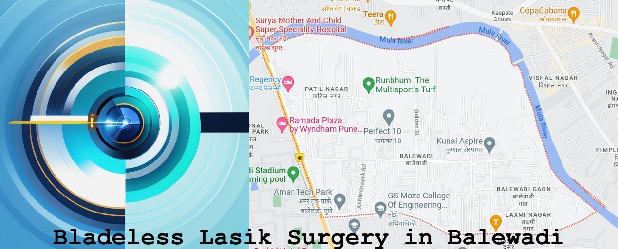 Bladeless Lasik surgery in Balewadi