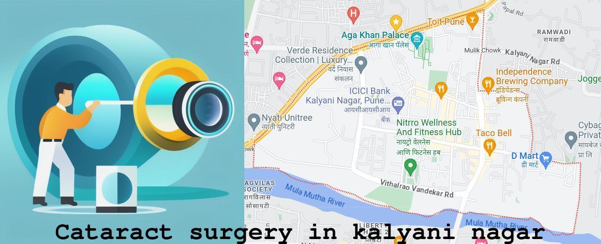 Cataract surgery in Kalyani Nagar