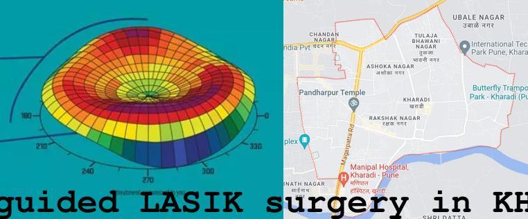 Topo-guided LASIK surgery in Kharadi