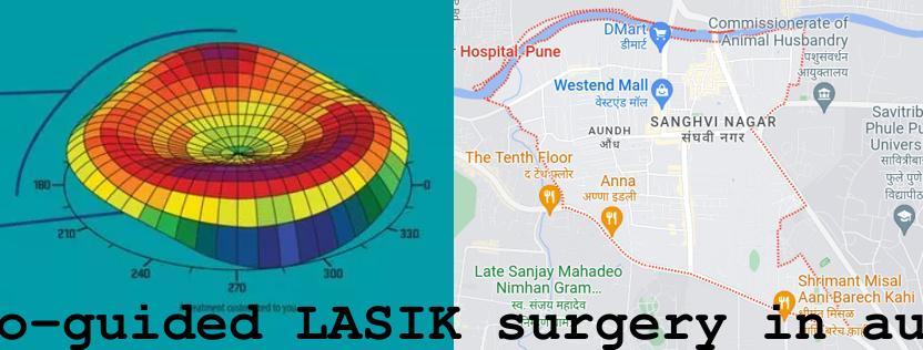 Topo-guided LASIK surgery in Aundh