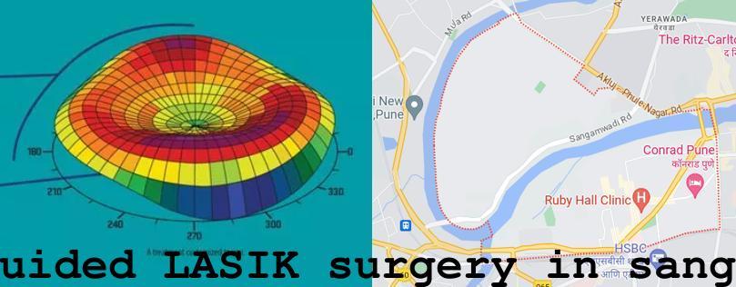 Topo-guided LASIK surgery in Bund Garden, Sangamvadi