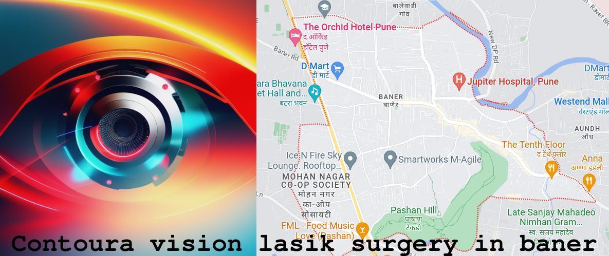 Contoura Vision LASIK Surgery in Baner