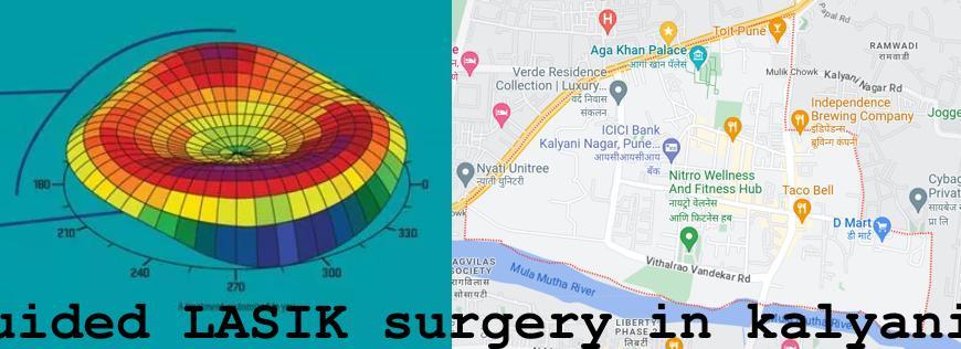 Topo-guided LASIK surgery in Kalyani Nagar