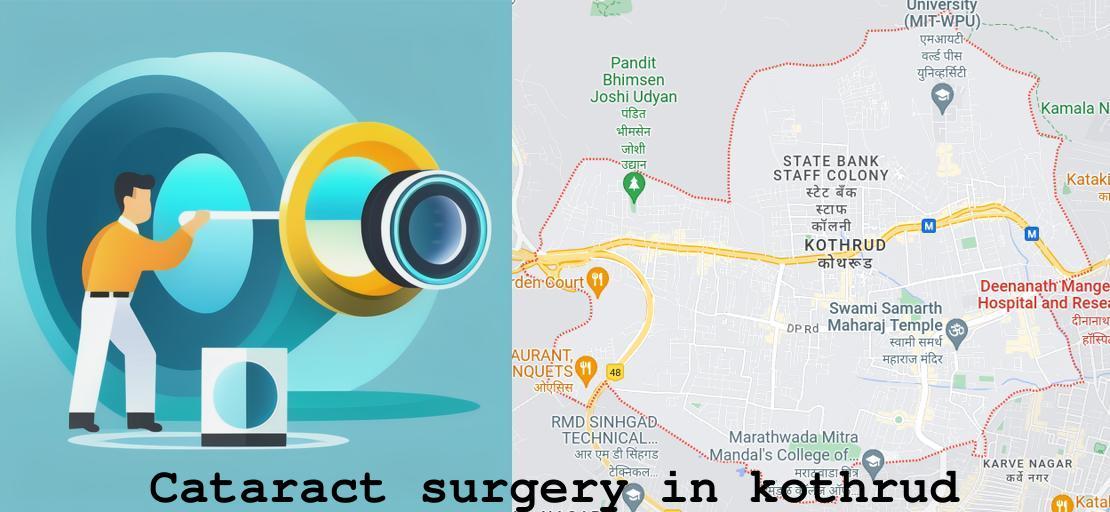 Cataract surgery in Kothrud