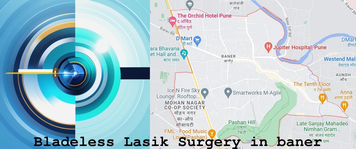Bladeless Lasik surgery in Baner